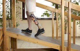 Illustrasjonsbilde av person med fotprotese.